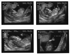 Screen shot 2010-02-02 at 11.29.14 AM