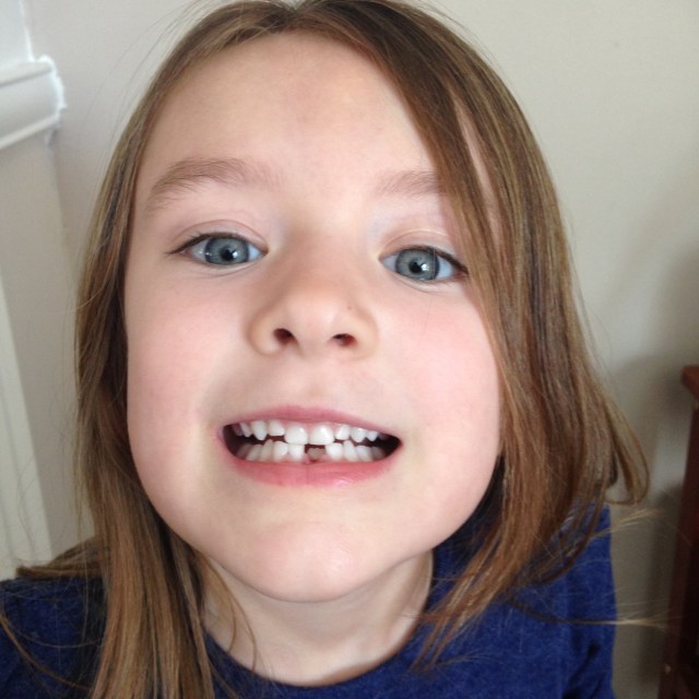 04-15-16 M first lost tooth